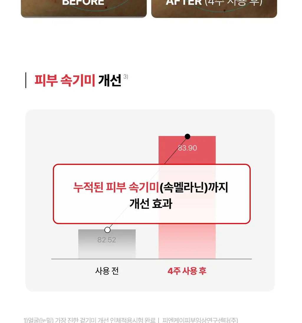 [색소침착/기미톤업제] 동국제약 멜라-셋 기미 토닝 크림 35g 상세페이지 18